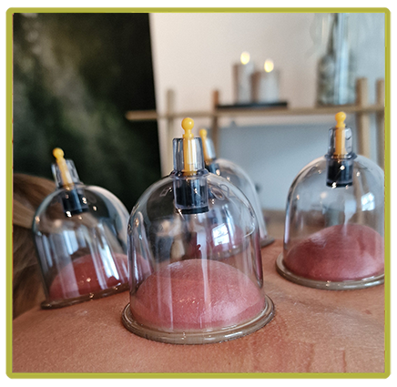 Cupping