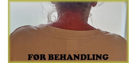 Holdningskorrektion